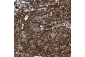 Immunohistochemical staining of human pancreas with CLCC1 polyclonal antibody  shows strong cytoplasmic positivity in exocrine glandular cells at 1:200-1:500 dilution.