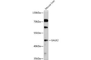 Western blot analysis of extracts of Mouse liver, using G antibody (ABIN7267329) at 1:1000 dilution. (GALK2 antibody  (AA 109-458))