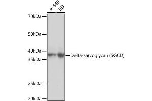 Western blot analysis of extracts of various cell lines, using Delta-sarcoglycan (SGCD) Rabbit mAb (ABIN7270144) at 1:1000 dilution. (SGCD antibody)