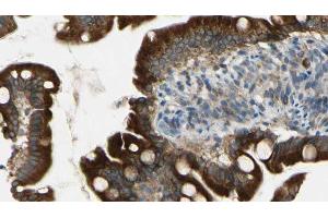 ABIN6269135 at 1/100 staining Mouse intestine tissue by IHC-P. (BCR antibody  (Internal Region))