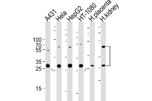 CTSA antibody  (N-Term)