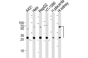 Western blot analysis of lysates from A431, Hela, HepG2, HT-1080 cell line and human placenta, kidney tissue lysate (from left to right), using CTSA Antibody (N-term) (ABIN654433 and ABIN2844169). (CTSA antibody  (N-Term))