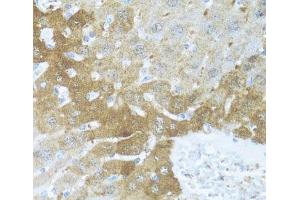 Immunohistochemistry of paraffin-embedded Mouse liver using BCL2L2 Polyclonal Antibody at dilution of 1:100 (40x lens). (BCL2L2 antibody)