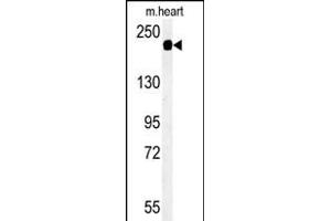 Western blot analysis of SD9L Antibody (C-term) (ABIN651359 and ABIN2840201) in mouse heart tissue lysates (35 μg/lane). (SAMD9L antibody  (C-Term))