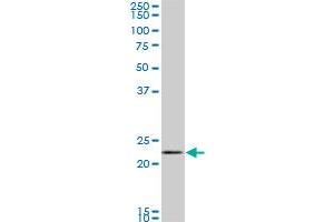 RAB11A monoclonal antibody (M01), clone 1F7-2A8. (RAB11A antibody  (AA 1-216))