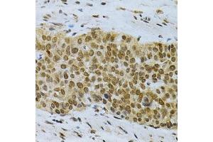 Immunohistochemistry (Paraffin-embedded Sections) (IHC (p)) image for anti-ELAV (Embryonic Lethal, Abnormal Vision, Drosophila)-Like 1 (Hu Antigen R) (ELAVL1) (AA 1-326) antibody (ABIN3022231)
