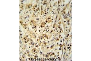Immunohistochemistry (IHC) image for anti-Small Cell Adhesion Glycoprotein (SMAGP) antibody (ABIN3002290) (SMAGP antibody)