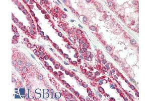 Immunohistochemistry (IHC) image for anti-Peripheral-Type Benzodiazepine Receptor (TSPO) (C-Term) antibody (ABIN185697)