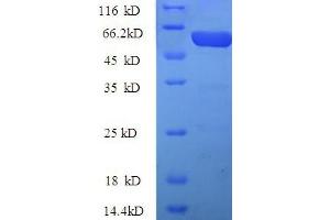 SDS-PAGE (SDS) image for Kynurenine 3-Monooxygenase (Kynurenine 3-Hydroxylase) (KMO) (AA 1-486), (full length) protein (His-SUMO Tag) (ABIN5709819) (KMO Protein (AA 1-486, full length) (His-SUMO Tag))