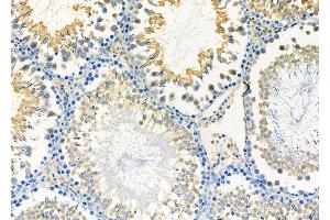 ABIN6263399 and ABIN6277160 at 1/100 staining Rat testis tissue by IHC-P. (Moesin antibody  (C-Term))