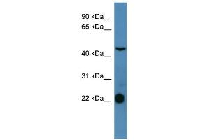 WB Suggested Anti-SSTR1 Antibody Titration: 0. (SSTR1 antibody  (C-Term))
