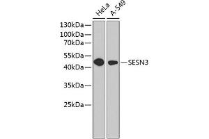 Western blot analysis of extracts of various cell lines, using SESN3 antibody (ABIN6129128, ABIN6147627, ABIN6147628 and ABIN6220862) at 1:1000 dilution. (SESN3 antibody  (AA 1-310))