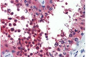 Testis, Human: Formalin-Fixed, Paraffin-Embedded (FFPE) (DNAJB1 antibody)
