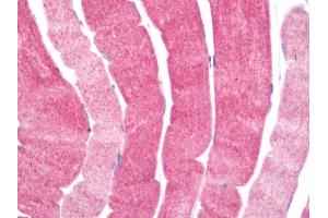 Human Skeletal Muscle: Formalin-Fixed, Paraffin-Embedded (FFPE) (PDCL3 antibody  (C-Term))