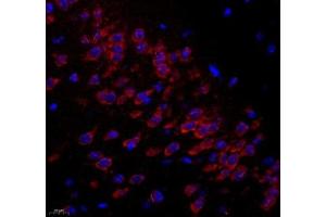 Immunofluorescence of paraffin embedded mouse hippocampus using C1orf173 (ABIN7074073) at dilution of 1: 300 (400x lens) (Glutamate-Rich Protein 3 (ERICH3) antibody)