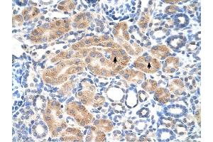 PDE9A antibody was used for immunohistochemistry at a concentration of 4-8 ug/ml to stain Epithelial cells of renal tubule (arrows) in Human Kidney.