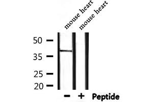 Western blot analysis of extracts from mouse heart, using BMI1 Antibody. (BMI1 antibody  (Internal Region))