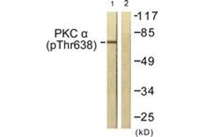 Western blot analysis of extracts from NIH-3T3 cells treated with UV 15', using PKC alpha (Phospho-Thr638) Antibody. (PKC alpha antibody  (pThr638))