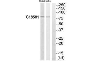 Western blot analysis of extracts from HepG2 cells and COLO205 cells, using NEK5 antibody. (NEK5 antibody)