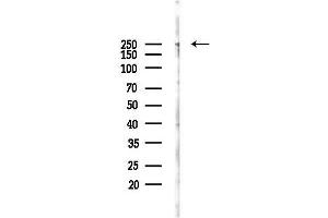 anti-WNK Lysine Deficient Protein Kinase 1 (WNK1) (pThr60) antibody