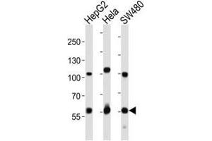 Western Blotting (WB) image for anti-Proprotein Convertase Subtilisin/kexin Type 9 (PCSK9) (AA 144-173) antibody (ABIN3032339)