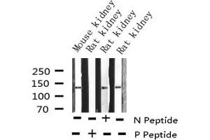 Western blot analysis of Phospho-Calcium Sensing Receptor (Thr888) expression in various lysates (CASR antibody  (pThr888))