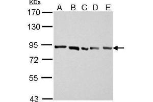 WB Image APLP2 antibody [N1N2], N-term detects APLP2 protein by Western blot analysis. (APLP2 antibody  (N-Term))