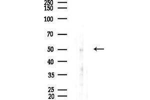 anti-WAS Protein Family, Member 3 (WASF3) (Internal Region) antibody
