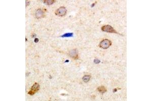 Immunohistochemical analysis of EDG5 staining in human brain formalin fixed paraffin embedded tissue section. (S1PR2 antibody  (C-Term))