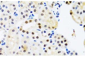 Immunohistochemistry of paraffin-embedded Mouse kidney using SET Polyclonal Antibody at dilution of 1:100 (40x lens). (SET/TAF-I antibody)
