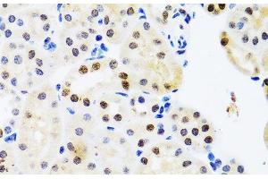 Immunohistochemistry of paraffin-embedded Mouse kidney using SET Polyclonal Antibody at dilution of 1:100 (40x lens).
