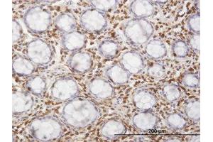 Image no. 1 for anti-Hematopoietic Cell-Specific Lyn Substrate 1 (HCLS1) (AA 266-356) antibody (ABIN598725) (HCLS1 antibody  (AA 266-356))