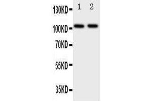 Anti-Zonula occludens protein 3 antibody, Western blotting Lane 1: Rat Brain Tissue Lysate Lane 2: Rat Heart Tissue Lysate (TJP3 antibody  (C-Term))