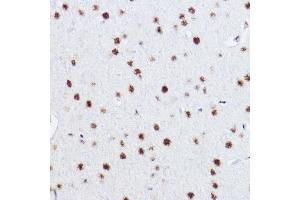 Immunohistochemistry of paraffin-embedded rat brain using p73 Rabbit mAb (ABIN1678945, ABIN1678944, ABIN7101487 and ABIN7101488) at dilution of 1:100 (40x lens). (Tumor Protein p73 antibody)