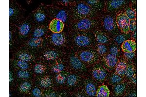 Immunocytochemistry (ICC) image for anti-FYN Oncogene Related To SRC, FGR, YES (FYN) (AA 7-176) antibody (ABIN94311)