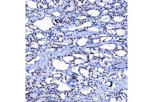 IHC analysis of SF3A1 using anti-SF3A1 antibody (ABIN7600556). (SF3A1 antibody  (AA 20-556))