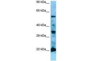 Image no. 1 for anti-GTPase NRas (NRAS) (AA 91-140) antibody (ABIN6749779) (GTPase NRas antibody  (AA 91-140))