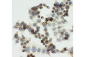 Immunocytochemistry (ICC) image for anti-Insulin-Like Growth Factor 2 Receptor (IGF2R) (C-Term) antibody (ABIN3031349)