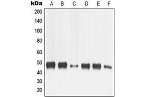 Western blot analysis of MMP13 expression in HeLa (A), SP2/0 (B), H9C2 (C), MCF7 (D), HT1080 (E), SCC4 (F) whole cell lysates. (MMP13 antibody  (N-Term))