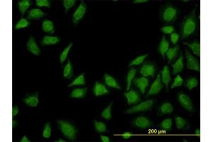 Immunofluorescence of monoclonal antibody to MTAP on HeLa cell. (MTAP antibody  (AA 1-154))