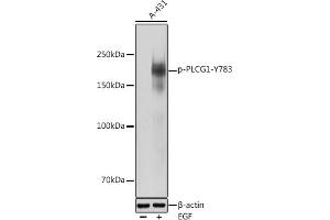 Western blot analysis of extracts of A-431 cells, using Phospho-PLC gamma 1 (PLCG1)-Y783 antibody (ABIN3019685, ABIN3019686, ABIN3019687 and ABIN1681934) at 1:1000 dilution. (Phospholipase C gamma 1 antibody  (pTyr783))