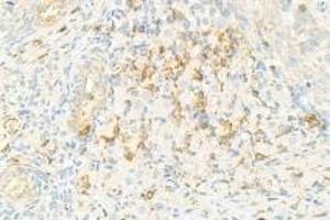 Immunohistochemistry analysis of paraffin-embedded rat ovary using,NRK (ABIN7074842) at dilution of 1: 1500 (NRK antibody)