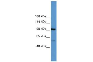 WB Suggested Anti-LPA Antibody Titration: 0. (LPA antibody  (Middle Region))
