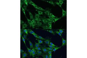 Immunofluorescence (IF) image for anti-Nuclear Factor-kB p65 (NFkBP65) (AA 50-180) antibody (ABIN3016235)