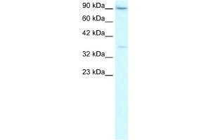 WB Suggested Anti-TBP Antibody Titration:  2. (TBP antibody  (Middle Region))
