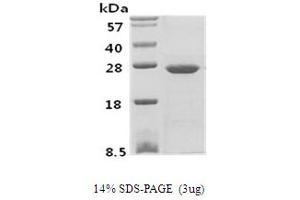 SDS-PAGE (SDS) image for Phosphoserine Phosphatase (PSPH) protein (ABIN666688)