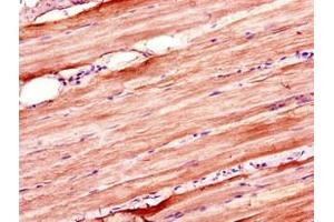 Immunohistochemistry of paraffin-embedded human skeletal muscle tissue using ABIN7176655 at dilution of 1:100 (ZSWIM6 antibody  (AA 430-583))