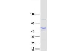 Validation with Western Blot (Trmt11 Protein (Myc-DYKDDDDK Tag))