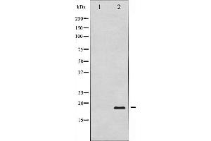 Western blot analysis of Pin1 expression in COS7 whole cell lysates,The lane on the left is treated with the antigen-specific peptide. (PIN1 antibody)