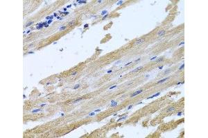 Immunohistochemistry of paraffin-embedded Rat heart using NSF Polyclonal Antibody at dilution of 1:100 (40x lens). (NSF antibody)